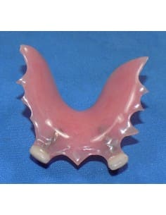 Repaired partial denture teeth
