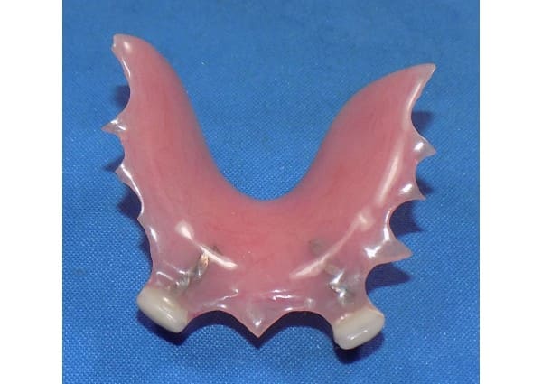 Repaired partial denture teeth