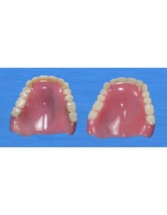 Duplicate upper denture