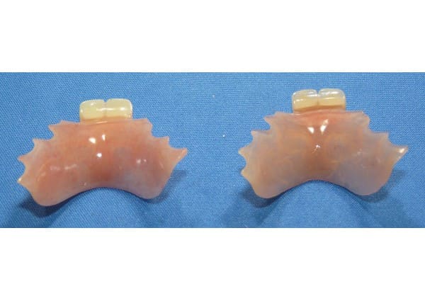 Duplicate partial denture