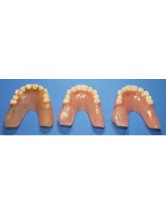 Duplicate dentures