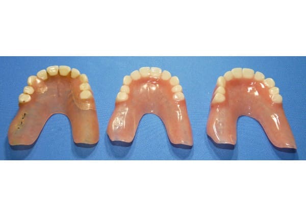 Duplicate dentures