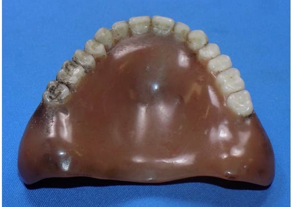 Stained upper denture