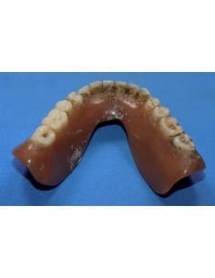 Stained lower denture