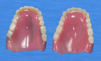 duplicat-dentures