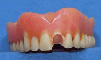 teeth-repair.png